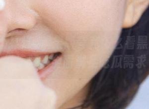 苹果版夸克怎么看黑料不打烊视频，全面满足吃瓜需求